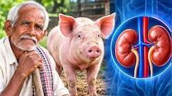 ಕಿಡ್ನಿ ವೈಫಲ್ಯದಿಂದ ಸಾವು-ಬದುಕಿನ ನಡುವೆ ಹೋರಾಟ.. ಹಂದಿಯಿಂದಲೇ ವ್ಯಕ್ತಿಗೆ ಹೊಸ ಜೀವನ 