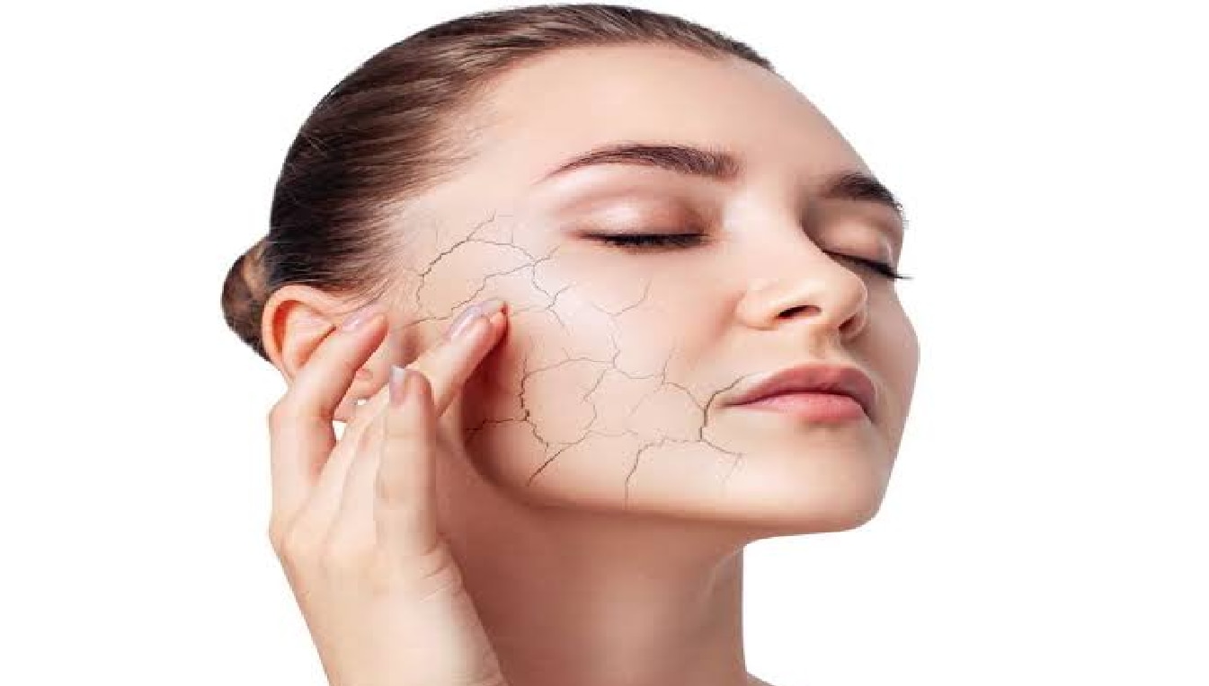 Dry Skin Care Tips