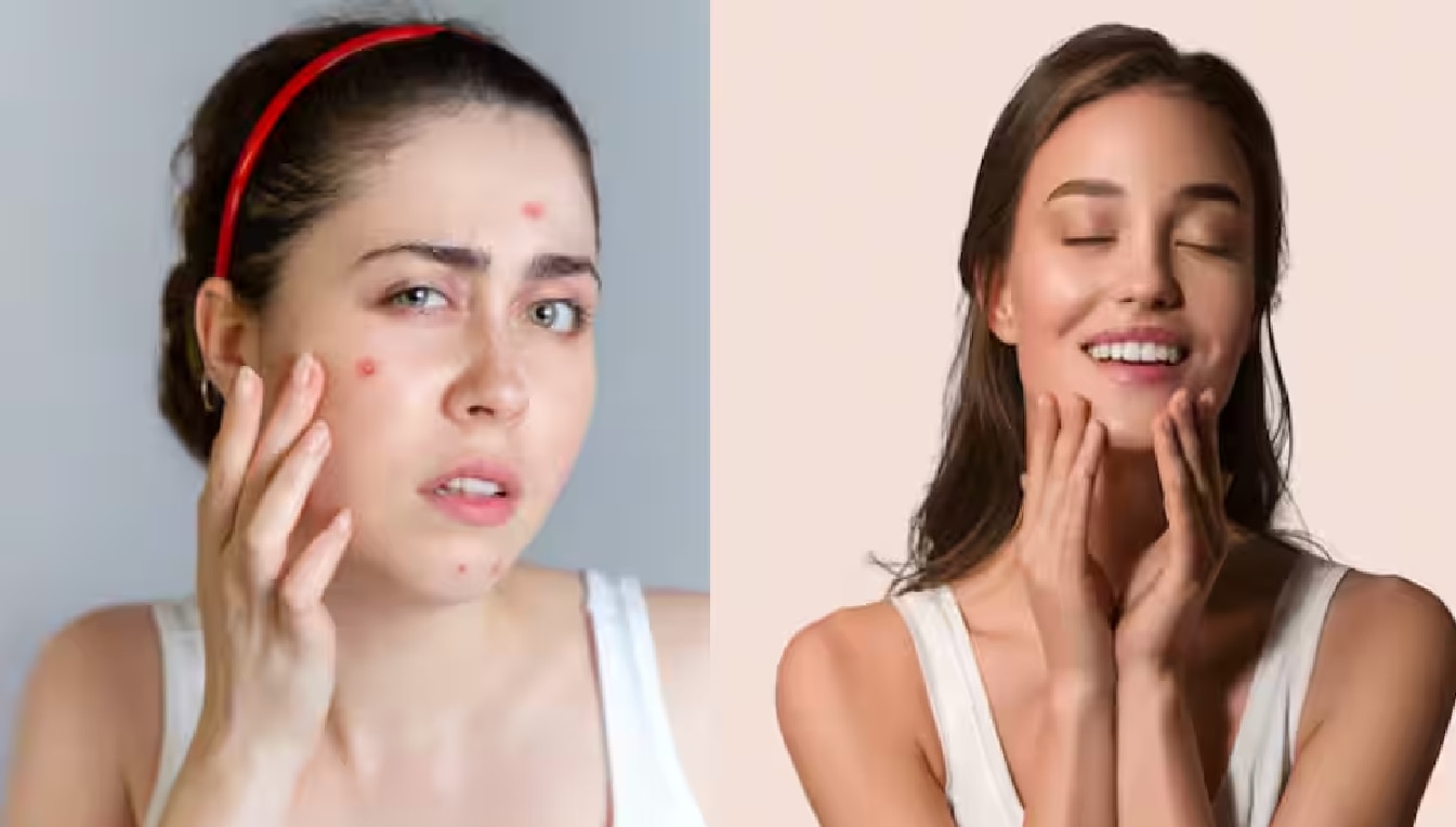 Dry Skin Care Tips