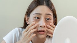 ಬೆಳಿಗ್ಗೆ ಎದ್ದಾಗ ನಿಮ್ಮ ಮುಖ ಊದಿಕೊಂಡಂತೆ ಕಾಣುತ್ತಿದೆಯೇ?.. ನಿಜವಾದ ಕಾರಣಗಳು ಇವು!