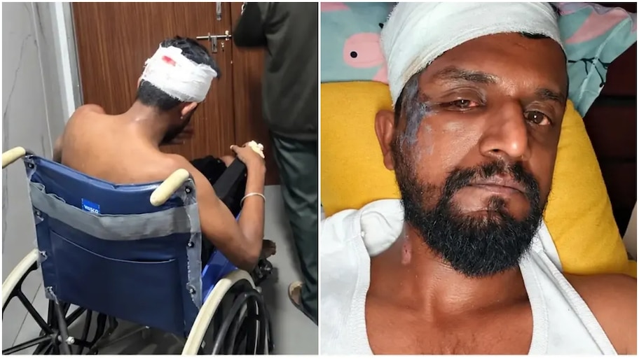ಕಿರಿಕ್ ಕೀರ್ತಿಗೆ ಭೀಕರ ಅಪಘಾತ : ಫೋಟೋಸ್‌ ವೈರಲ್‌.. ಹೇಗಿದೆ ಮಾಜಿ ಬಿಗ್‌ ಬಾಸ್‌ ಸ್ಪರ್ಧಿ ಆರೋಗ್ಯ?