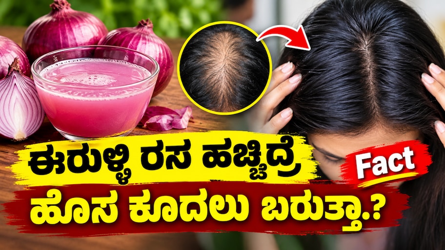 ಬೋಳು ತಲೆಗೆ ಈರುಳ್ಳಿ ರಸ ಹಚ್ಚಿದ್ರೆ ಹೊಸ ಕೂದಲು ಬರುತ್ತಾ.? ಇಲ್ಲಿದೆ ಶಾಕ್‌ ಸತ್ಯ